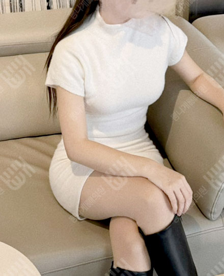腕の脂肪吸引9 후