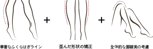 華奢なふくらはぎライン + 
歪んだ形状の矯正 + 
全体的な脚線美の考慮
