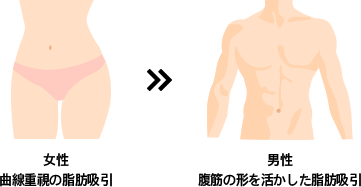 女性 曲線重視の脂肪吸引>>男性 腹筋の形を活かした脂肪吸引