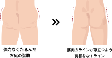 弾力なくたるんだ お尻の脂肪 >> 筋肉のラインが際立つ よう調和をなすライン 